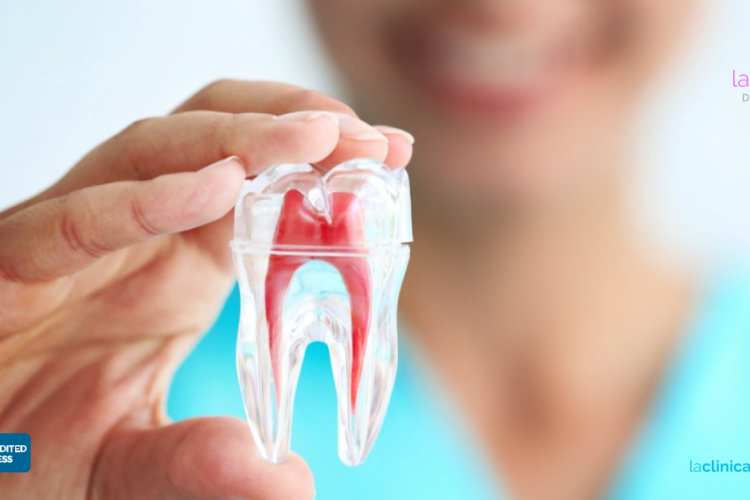 Que es una endodoncia y cuales son sus mitos