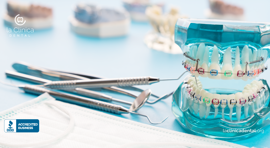 Un mal tratamiento de brackets puede ocasionar perdida de dientes
