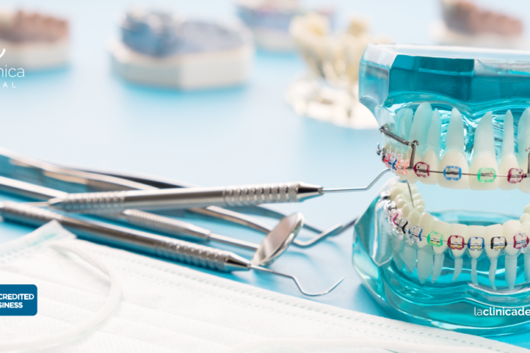 Un mal tratamiento de brackets puede ocasionar perdida de dientes